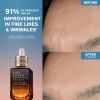 Advanced Night Repair Serum Synchronized Multi-Recovery Complex -arvostelut