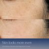 Advanced Night Repair Serum Synchronized Multi-Recovery Complex -arvostelut