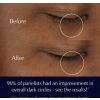 Advanced Night Repair Eye Supercharged Gel-Creme Eye Cream Limited Edition -purkissa