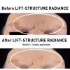 NOSTORAKENNE RADIANCE